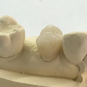 Bild von Steve Butler Dental Ceramics Ltd