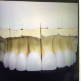 Bild von Steve Butler Dental Ceramics Ltd