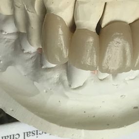 Bild von Steve Butler Dental Ceramics Ltd