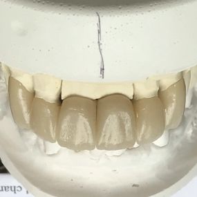 Bild von Steve Butler Dental Ceramics Ltd