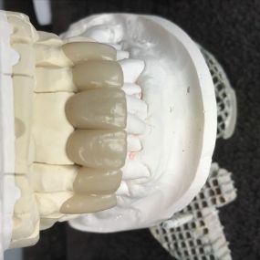 Bild von Steve Butler Dental Ceramics Ltd