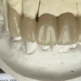 Bild von Steve Butler Dental Ceramics Ltd