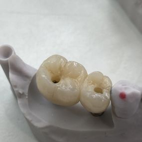 Bild von Steve Butler Dental Ceramics Ltd