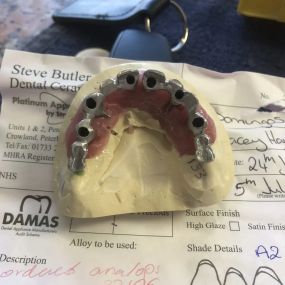 Bild von Steve Butler Dental Ceramics Ltd