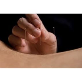 Bild von Zadi Hasan Barnet Acupuncture