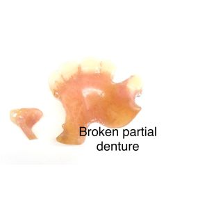 Bild von Mobile Denture Repair