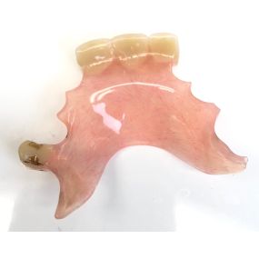 Bild von Mobile Denture Repair