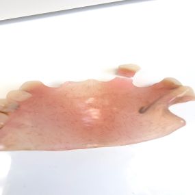 Bild von Mobile Denture Repair