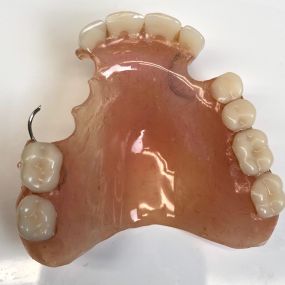 Bild von Mobile Denture Repair