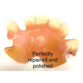 Bild von Mobile Denture Repair