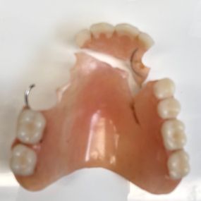 Bild von Mobile Denture Repair