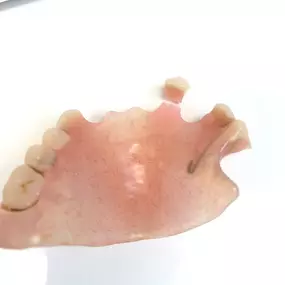 Bild von Mobile Denture Repair