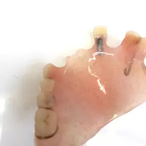 Bild von Mobile Denture Repair