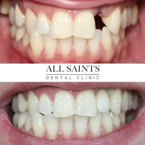 Bild von All Saints Dental Implant & Orthodontic Specialist Clinic