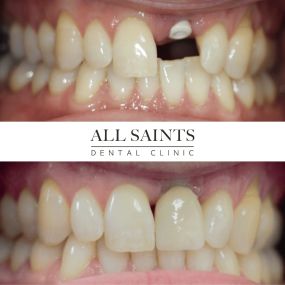 Bild von All Saints Dental Implant & Orthodontic Specialist Clinic