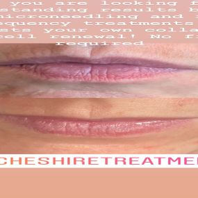 Bild von Cheshire Treatments
