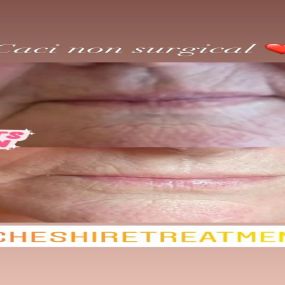 Bild von Cheshire Treatments