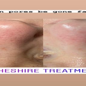 Bild von Cheshire Treatments