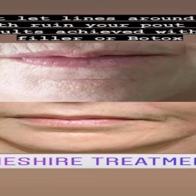 Bild von Cheshire Treatments