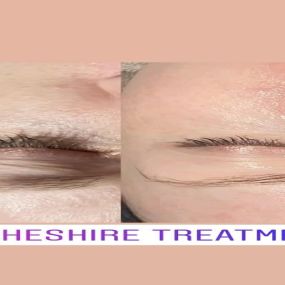 Bild von Cheshire Treatments