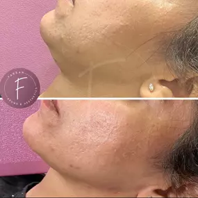 Bild von Farrah Brows & Aesthetics