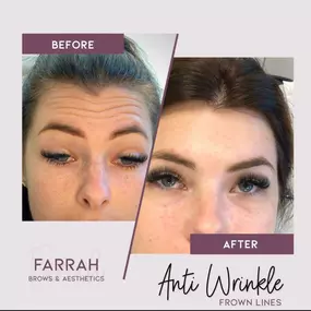 Bild von Farrah Brows & Aesthetics