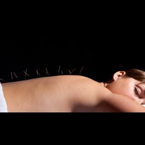 Bild von Acupuncture South Devon