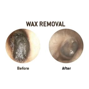 Bild von Cheshire Ear Wax Removal & Microsuction Services