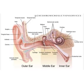 Bild von Cheshire Ear Wax Removal & Microsuction Services