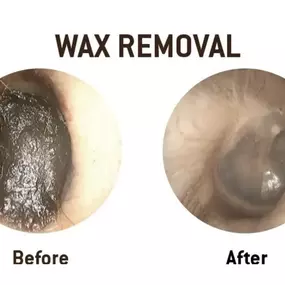 Bild von Cheshire Ear Wax Removal & Microsuction Services