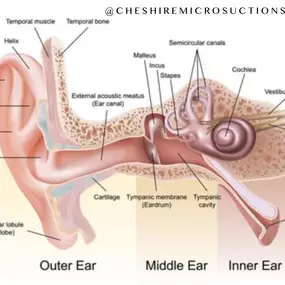 Bild von Cheshire Ear Wax Removal & Microsuction Services