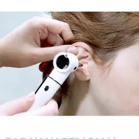Bild von Cheshire Ear Wax Removal & Microsuction Services