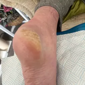 Bild von Feetfirst Mobile Footcare Practitioner