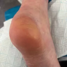 Bild von Feetfirst Mobile Footcare Practitioner