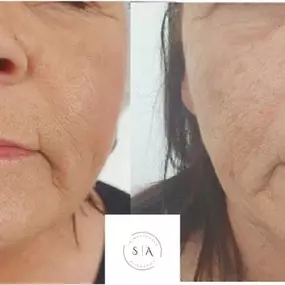 Bild von Skinpeccable Aesthetics and Holistic Therapy