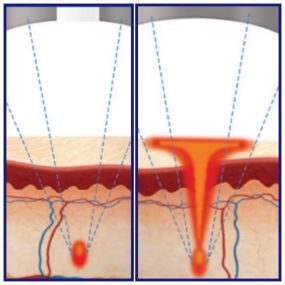 Bild von Skin Genie Laser Clinic