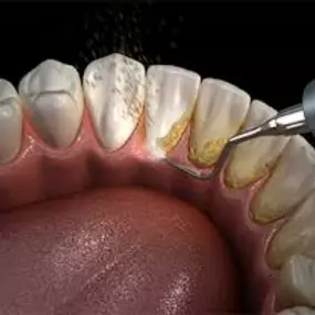 Bild von Bloods And Needles Academy Ltd