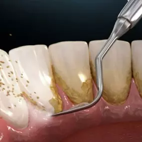 Bild von Bloods And Needles Academy Ltd