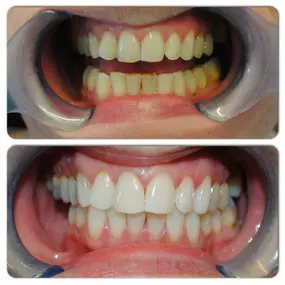 Bild von Bloods And Needles Academy Ltd