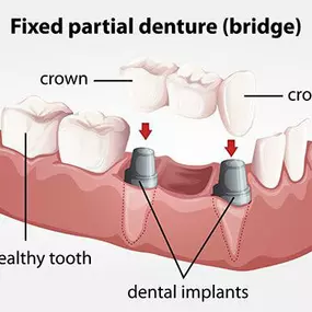 Bild von Lumon Dental