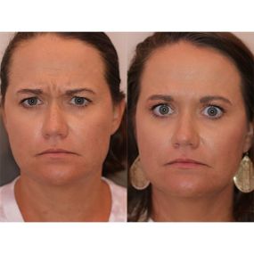 Bild von Destin Botox Laser and Facial Esthetics