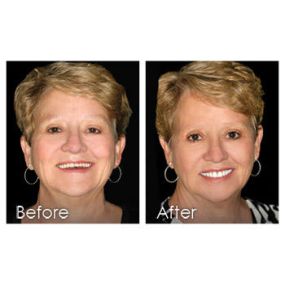 Center for Cosmetic Dentistry | Cleveland, TN | Dr. Kenneth Beard