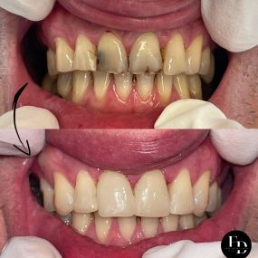 Bild von YOUR DENTAL ARTIST | Dr. Felix Denz | Zahnarzt 1040 Wien