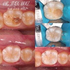 Bild von YOUR DENTAL ARTIST | Dr. Felix Denz | Zahnarzt 1040 Wien