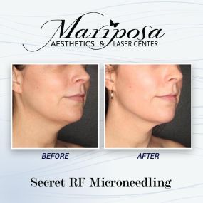 Bild von Mariposa Aesthetics & Laser Center