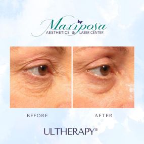 Bild von Mariposa Aesthetics & Laser Center