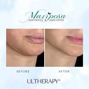 Bild von Mariposa Aesthetics & Laser Center