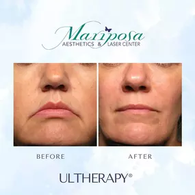 Bild von Mariposa Aesthetics & Laser Center