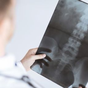 With digital and high-frequency equipment, we can take the highest quality radiographs with the lowest exposure to our patients.

One of the most important elements of chiropractic care is diagnostics. Chiropractic radiology is a tool utilized in care as a diagnostic practice to rule out pathology (such as possible tumor or fracture) and/or an additional aid to determine where to adjust the spine. Chiropractors rely on a variety of diagnostic techniques in order to fully understand what is occur