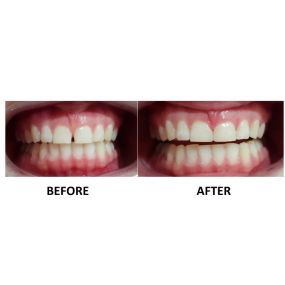 Bild von Smile Tech Dental & Implant Centre